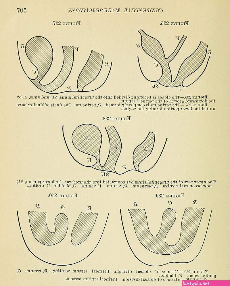 keniya girls small vagina picture details