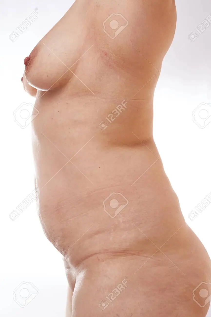 fat flabby woman nude pic