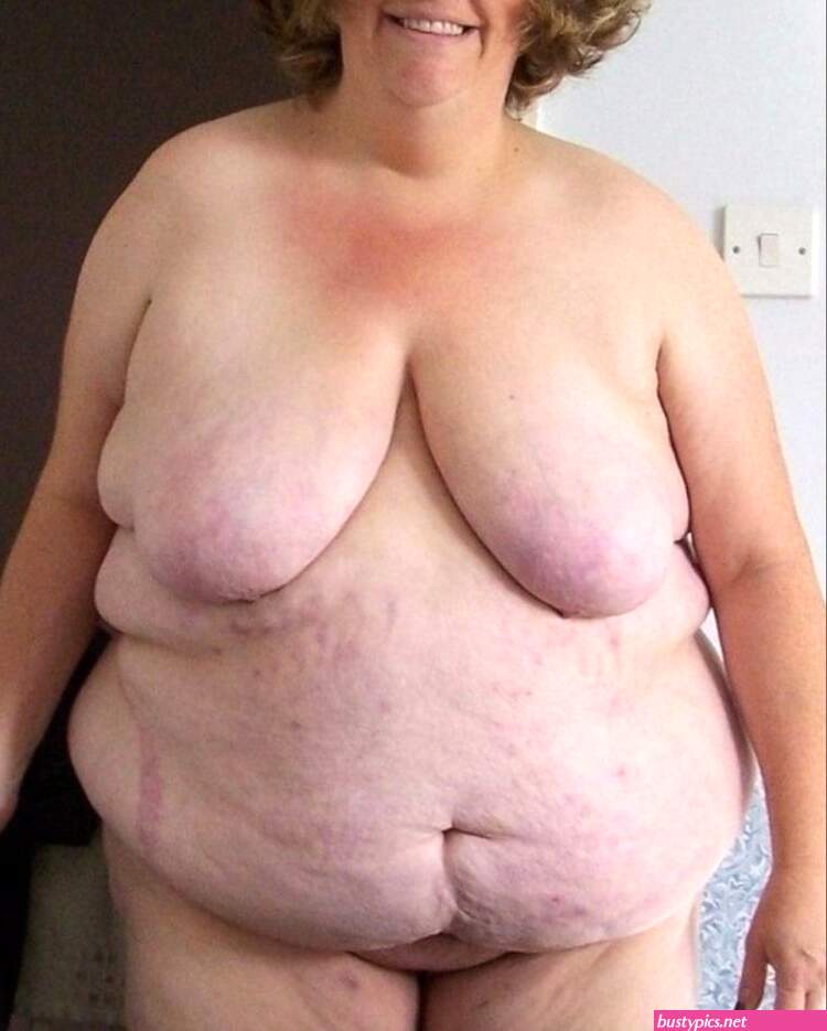 fat flabby woman nude pic