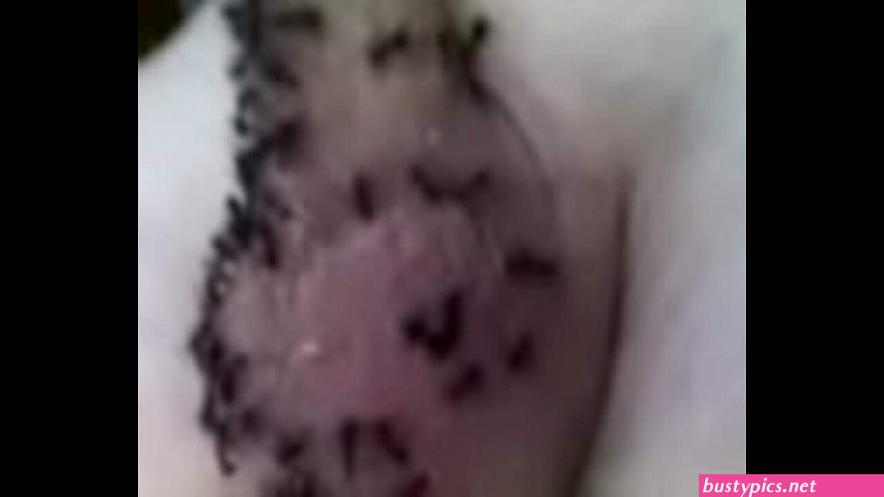 ant bites xxx